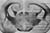 Figure 17.14