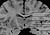 Figure 17.26